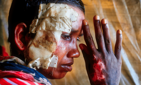 International court tells Myanmar to prevent Rohingya genocide