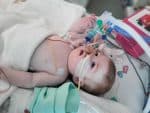 Baby girl whose life support was halted by British court, dies